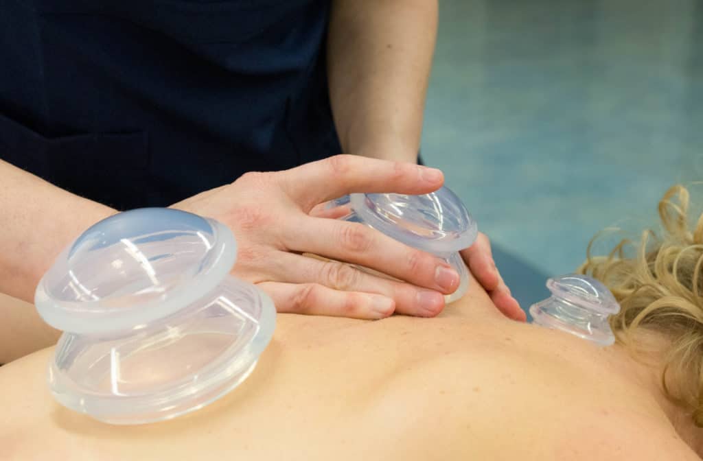 CUPPING WINDSOR CUPPING WINDSOR