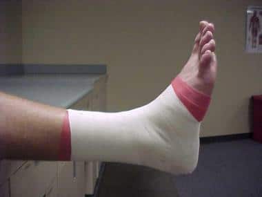 ANKLE TAPING WINDSOR ANKLE TAPING WINDSOR